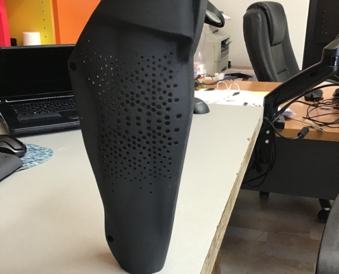 new stile stampa 3D Protesi